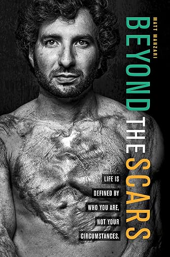 Beyond the Scars: Life is Defined by Who You Are, Not Your Circumstancesby Matt Manzari